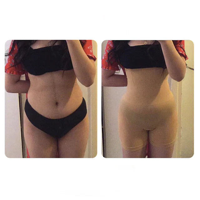 Waist Sculpting Shapewear™ - Slim Effortlessly & Embrace Your Curves